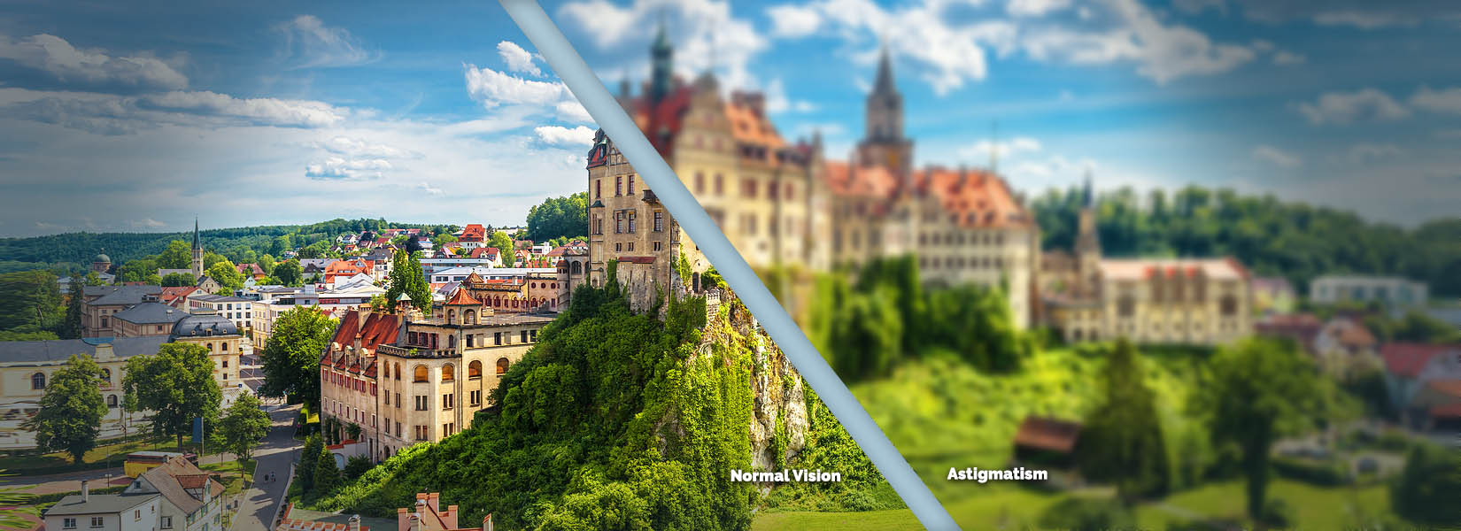 Astigmatism Treatment in Dayton