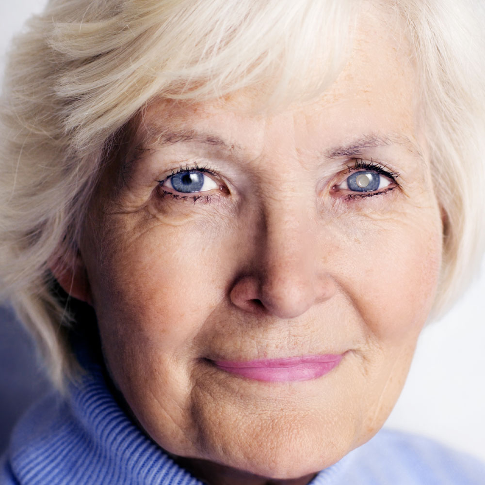 Cataract Surgery Co-Management in Dayton