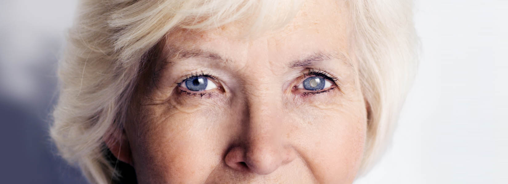 Cataract Surgery in Dayton